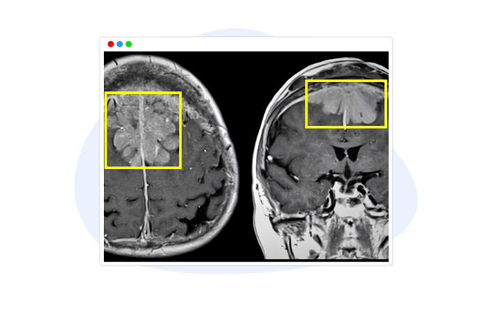 Medical Image Annotation 